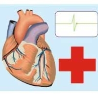 Posturi blocate, personal insuficient: Din cauza volumului prea mare de munca, o asistenta de la Spitalul "G.Alexandrescu" a facut infarct miocardic
