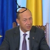Basescu are 3 pete pe cap: Arsuri de soare, imbatranire sau cancer?