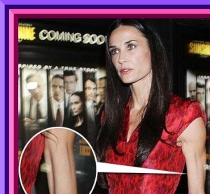 Actrita Demi Moore, internata la spital din cauza anorexiei si a depresiei