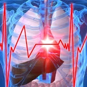Legatura dintre infarct, apa si aspirina