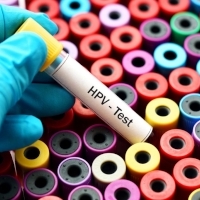 Infectia cu Papilloma virus uman (HPV) si cancerul de col uterin