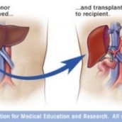 ZIUA NATIONALA A TRANSPLANTULUI IN ROMANIA