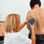 Euromelanoma Day 2017 se deschide cu o conferinta de presa