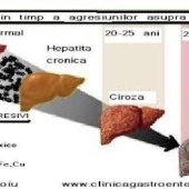 In Romania, in fiecare an mor 10.000 de oameni din cauza cirozei hepatice