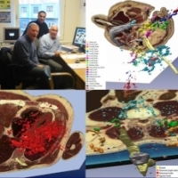 Un interviu exceptional cu prof. univ.dr. Ion-Christian Chiricuta, cel mai bun medic primar de radioterapie din Romania (4)