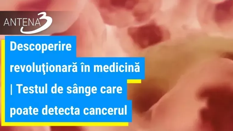 Descoperire revolutionara in medicina. Testul de sange care poate detecta cancerul