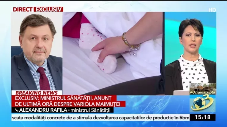 Ministrul Sanatatii, anunt despre variola maimutei